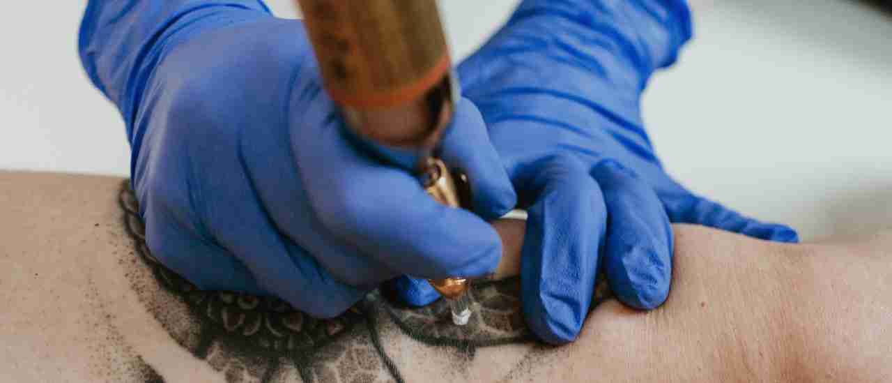 Cryotherapy treatment at Mirror Image Clinic